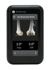 OrthoAlign handheld device
